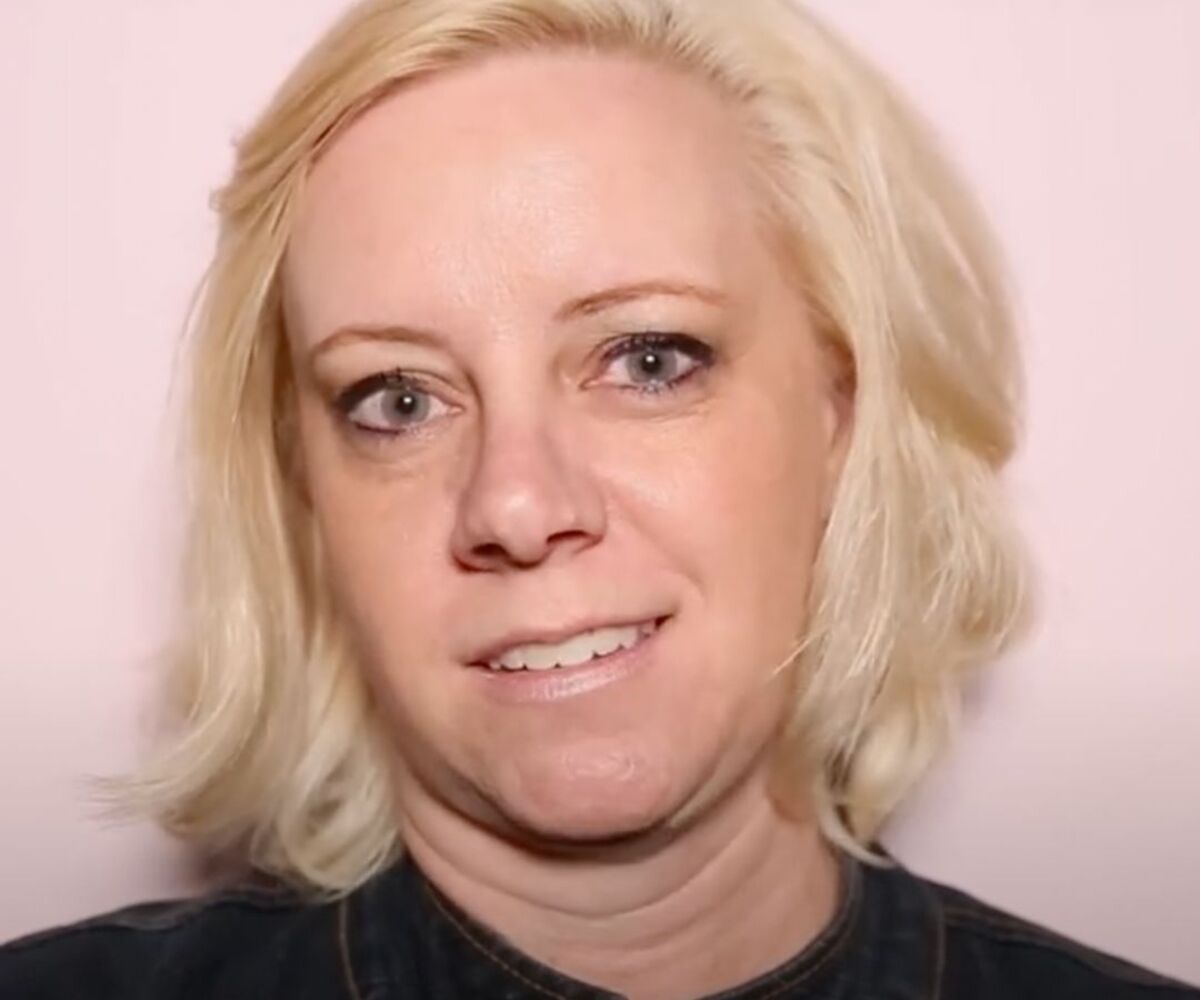 Better with Age:  Brooke’s Kybella Treatment